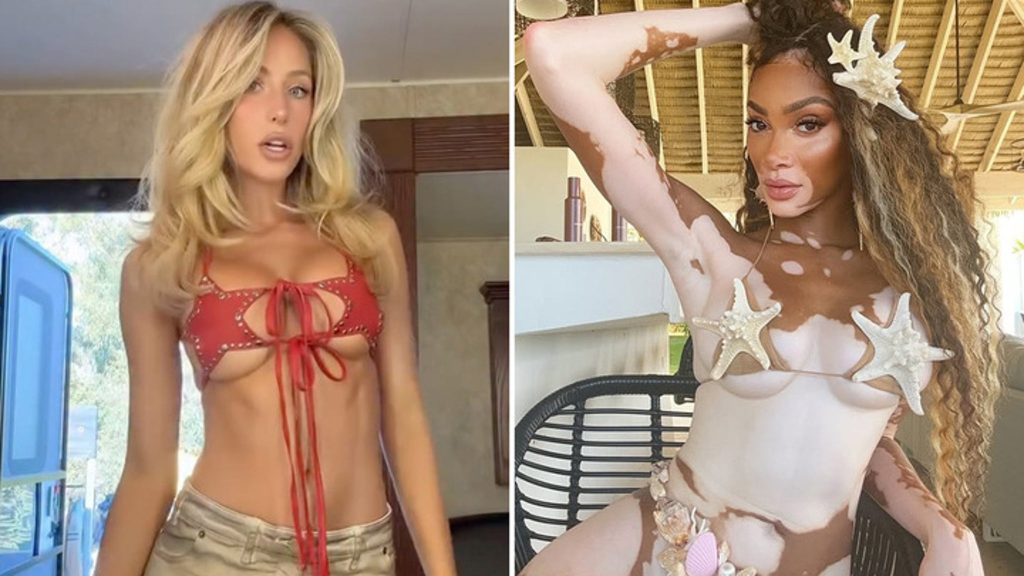 Alix Earle vs. Winnie Harlow siapa yang lebih Anda?!