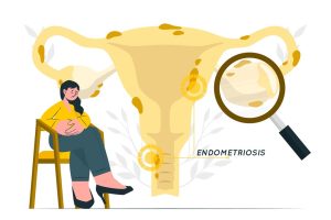 Tiga Cara Pemeriksaan tuba falopi, kerusakan terbanyak disebabkan infekssi dan endometriosis