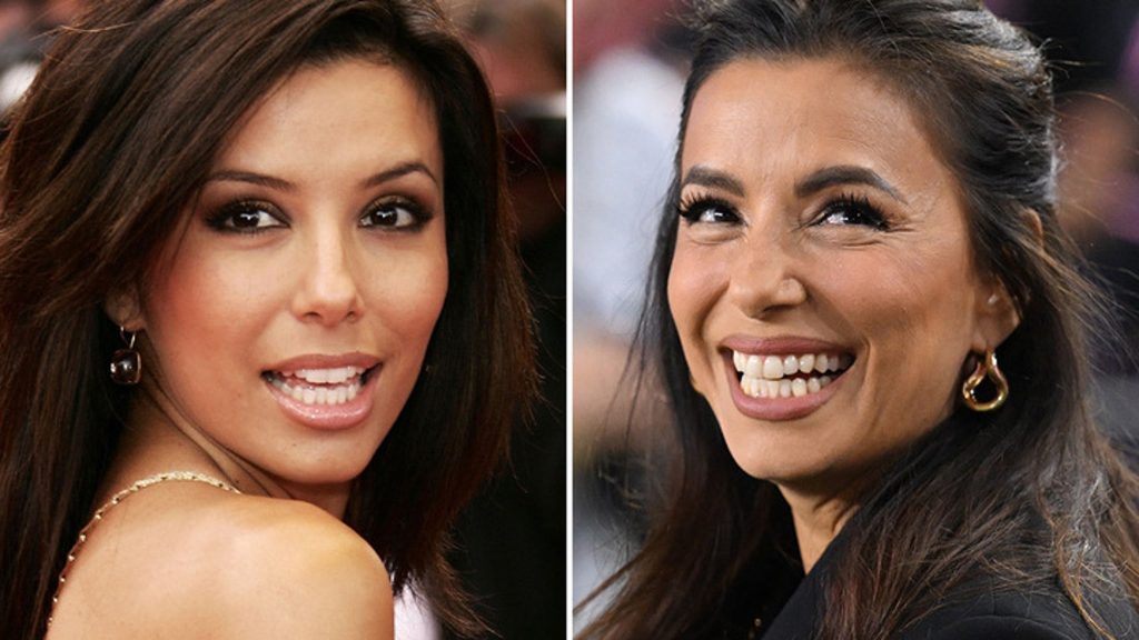 Eva Longoria Good Genes atau Good Docs?!