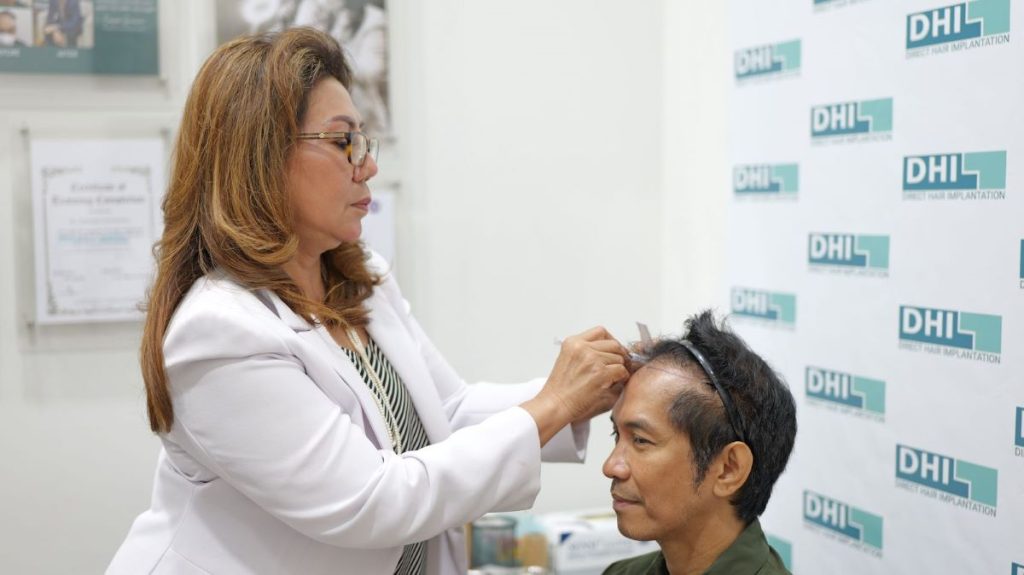 Tanam Rambut Tidak Optimal, Lakukan Retouch Pada Pasien Gagal Transplantasi Rambut